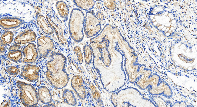 LAMB2 Antibody in Immunohistochemistry (Paraffin) (IHC (P))