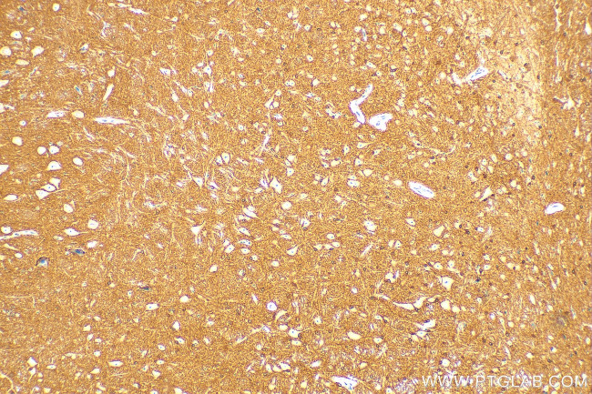 HCN2 Antibody in Immunohistochemistry (Paraffin) (IHC (P))
