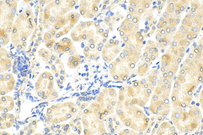 KIM-1/HAVCR1 Antibody in Immunohistochemistry (Paraffin) (IHC (P))
