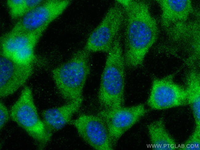 MIF Antibody in Immunocytochemistry (ICC/IF)