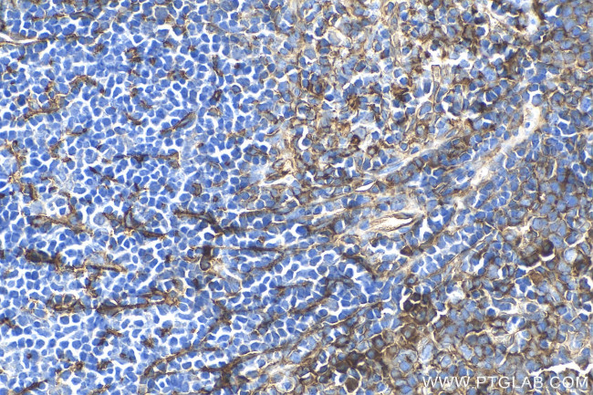 VCAM-1 Antibody in Immunohistochemistry (Paraffin) (IHC (P))