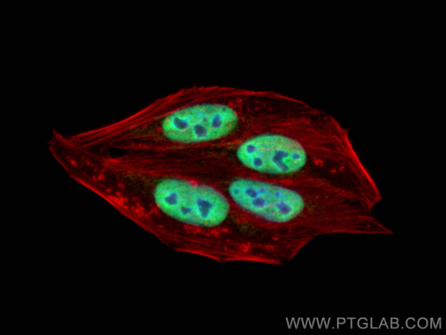 NCOA2 Antibody in Immunocytochemistry (ICC/IF)