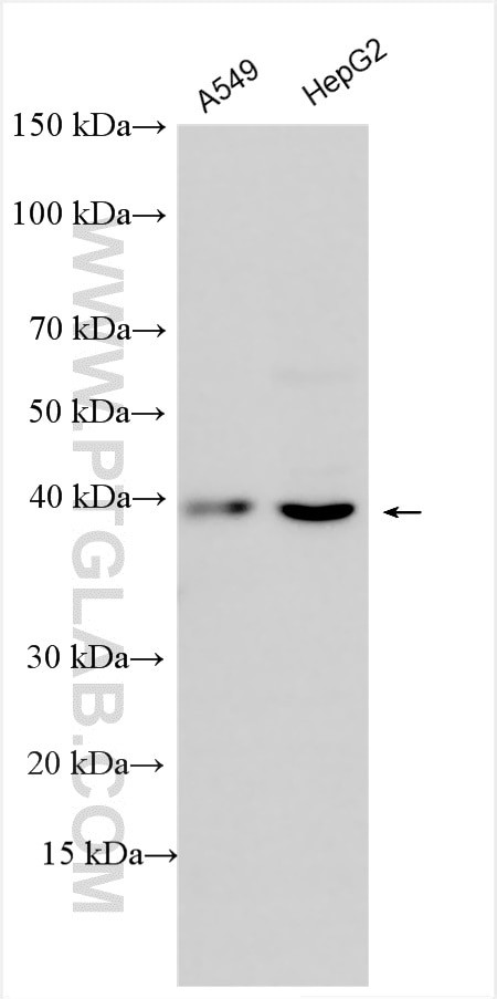AGTR2 Antibody in Western Blot (WB)