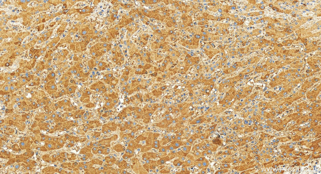 IL-1RAP Antibody in Immunohistochemistry (Paraffin) (IHC (P))