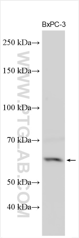 SLC6A9/GlyT1 Antibody in Western Blot (WB)