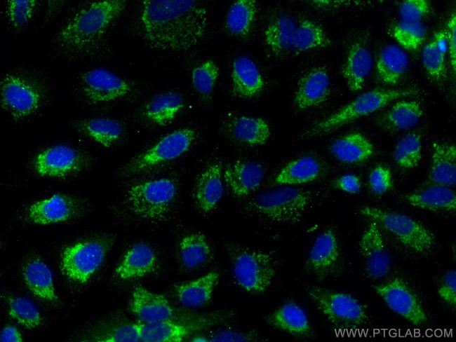 NLRP6 Antibody in Immunocytochemistry (ICC/IF)