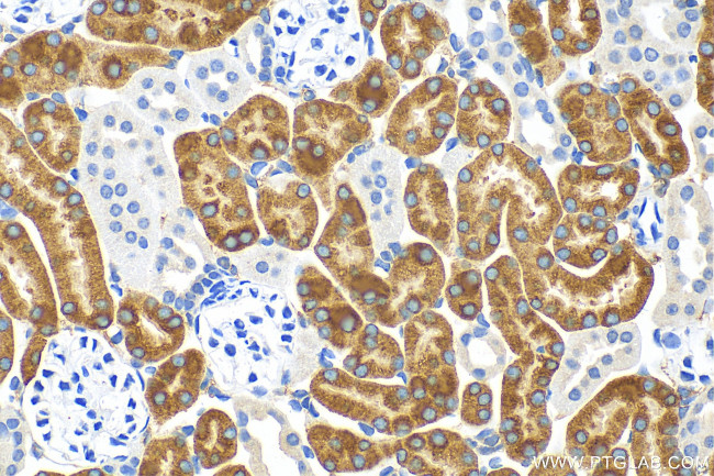 FMO1 Antibody in Immunohistochemistry (Paraffin) (IHC (P))
