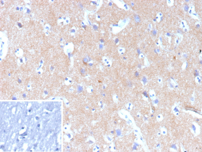 HK1/Hexokinase 1 Antibody in Immunohistochemistry (Paraffin) (IHC (P))
