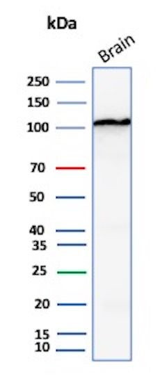 HK1/Hexokinase 1 Antibody in Western Blot (WB)