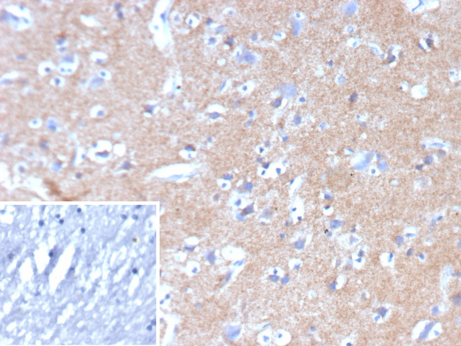 HK1/Hexokinase 1 Antibody in Immunohistochemistry (Paraffin) (IHC (P))