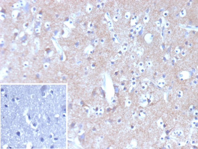 HK1/Hexokinase 1 Antibody in Immunohistochemistry (Paraffin) (IHC (P))