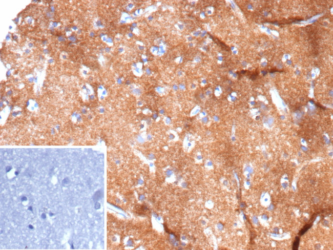 HK1/Hexokinase 1 Antibody in Immunohistochemistry (Paraffin) (IHC (P))