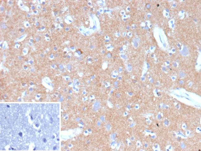 HK1/Hexokinase 1 Antibody in Immunohistochemistry (Paraffin) (IHC (P))
