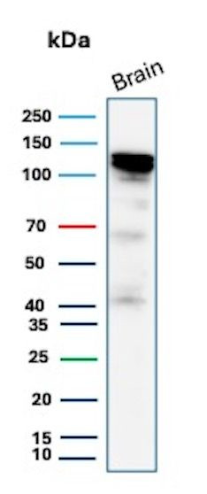 HK1/Hexokinase 1 Antibody in Western Blot (WB)