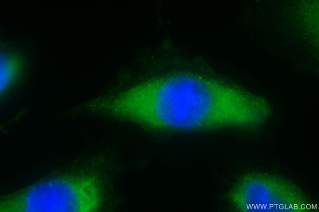 DDX60 Antibody in Immunocytochemistry (ICC/IF)