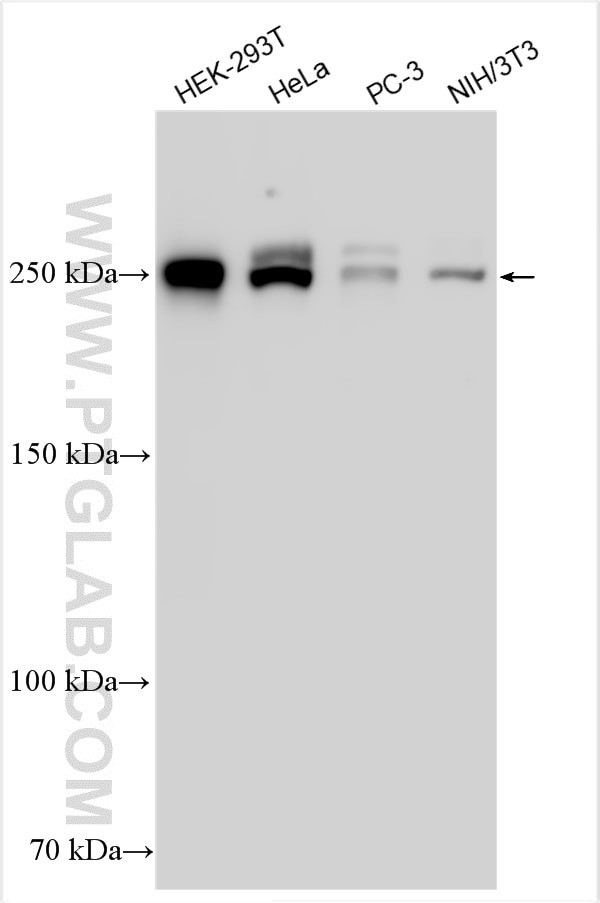 BAZ2A Antibody in Western Blot (WB)
