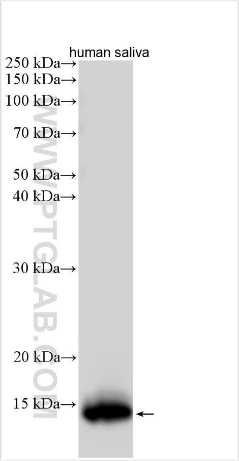 CST5 Antibody in Western Blot (WB)