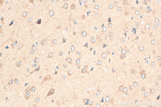 FPR2 Antibody in Immunohistochemistry (Paraffin) (IHC (P))