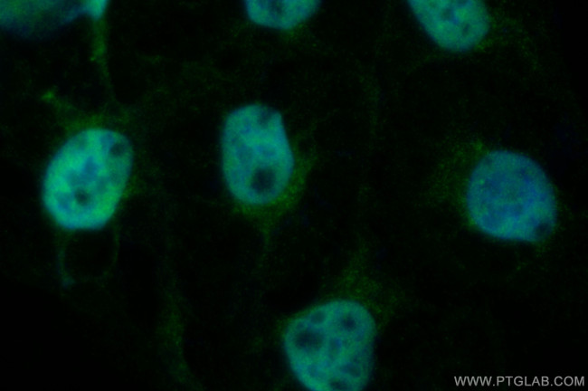 RBM12 Antibody in Immunocytochemistry (ICC/IF)