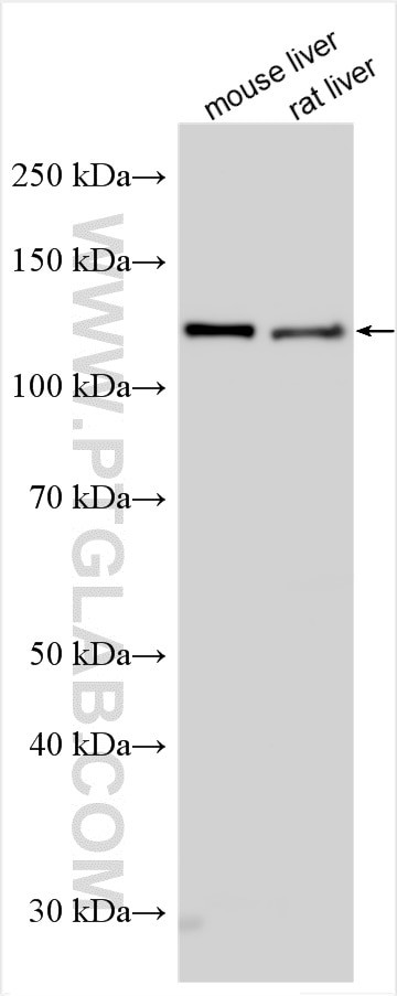 IRS4 Antibody in Western Blot (WB)