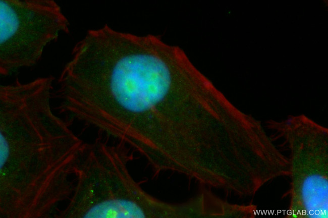 CD3EAP Antibody in Immunocytochemistry (ICC/IF)