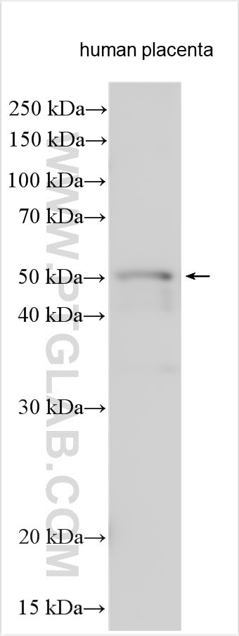 SHBG Antibody in Western Blot (WB)