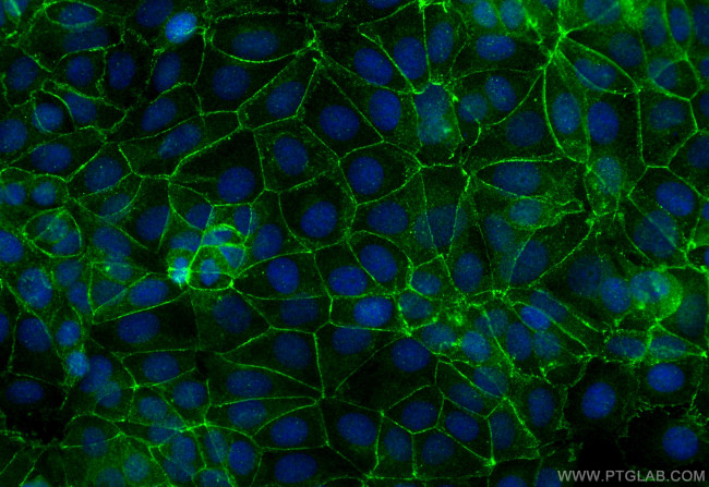 Nectin-4/PVRL4 Antibody in Immunocytochemistry (ICC/IF)