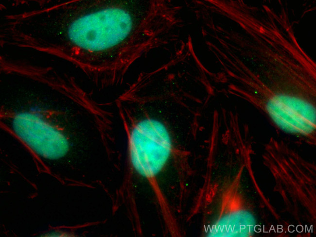MLLT1 Antibody in Immunocytochemistry (ICC/IF)