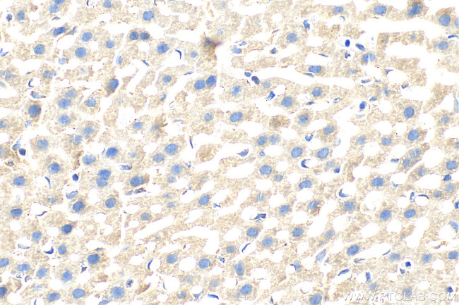 SLC46A3 Antibody in Immunohistochemistry (Paraffin) (IHC (P))