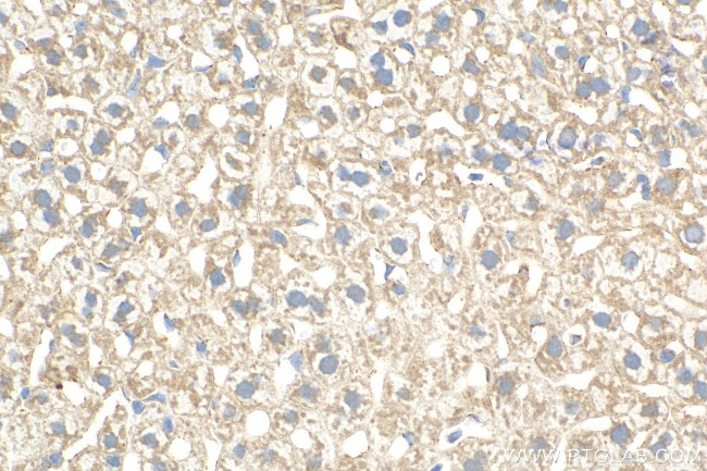 ADAMTS2 Antibody in Immunohistochemistry (Paraffin) (IHC (P))