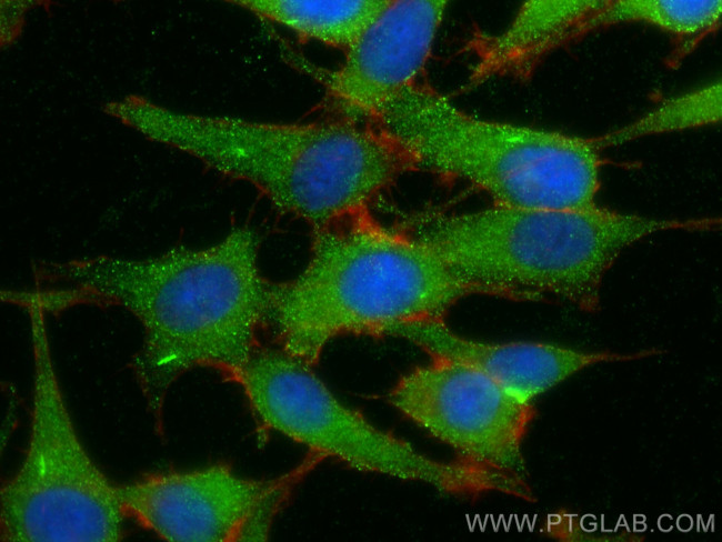LRRC7 Antibody in Immunocytochemistry (ICC/IF)