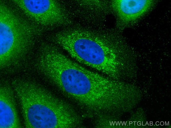 NRG1, isoform Alpha Antibody in Immunocytochemistry (ICC/IF)