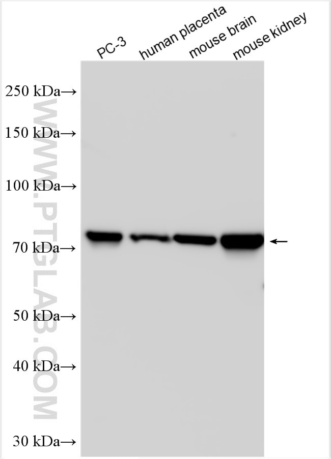 TRPV6 Antibody in Western Blot (WB)