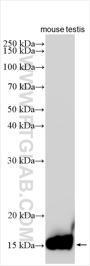 Histone H2B Antibody in Western Blot (WB)