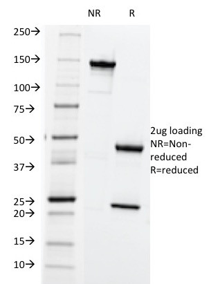 HLA-ABC (MHC I) Antibody in SDS-PAGE (SDS-PAGE)
