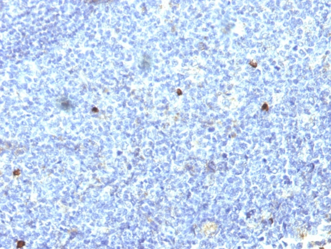 Bio Aw32 Color HLA-Aw32 and HLA-A25 (MHC I) Monoclonal Antibody (SPM418) (3105-MSM4X ...