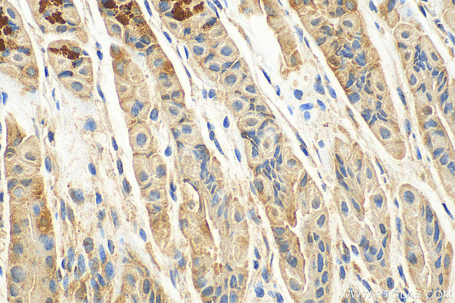 CLPX Antibody in Immunohistochemistry (Paraffin) (IHC (P))