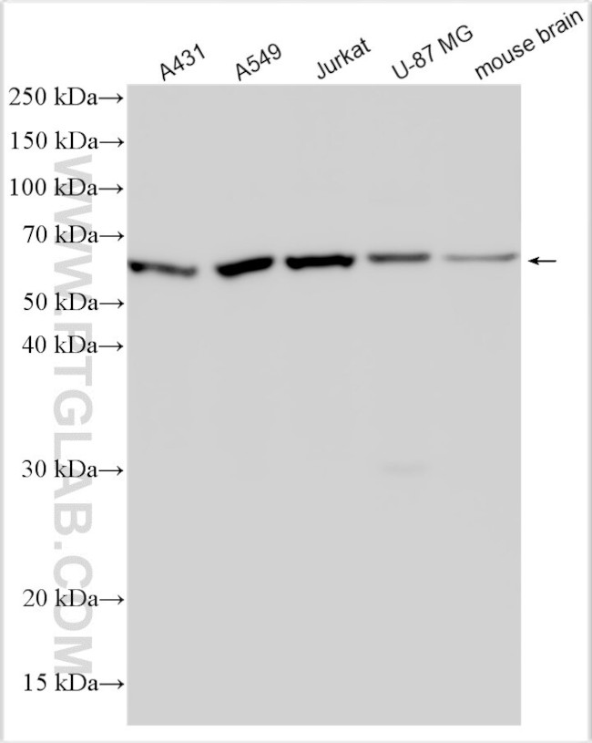 TRIM43 Antibody in Western Blot (WB)