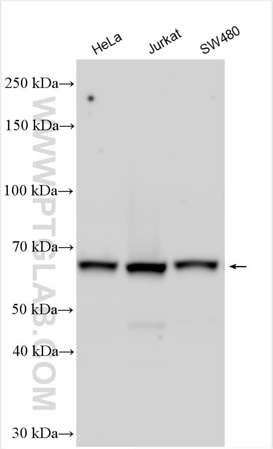 UTP18 Antibody in Western Blot (WB)