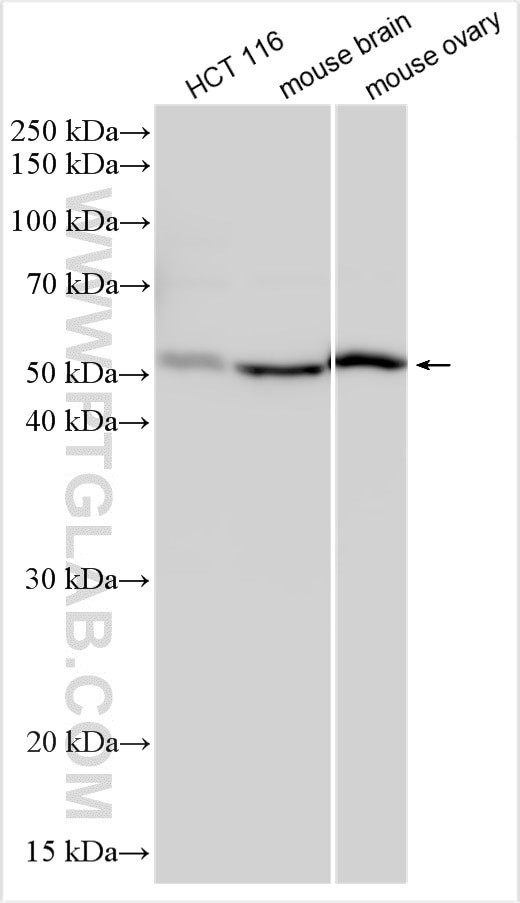 SMOC2 Antibody in Western Blot (WB)