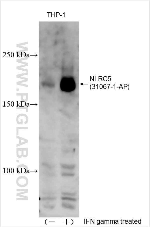 NLRC5 Antibody in Western Blot (WB)