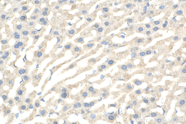 SLC22A10 Antibody in Immunohistochemistry (Paraffin) (IHC (P))
