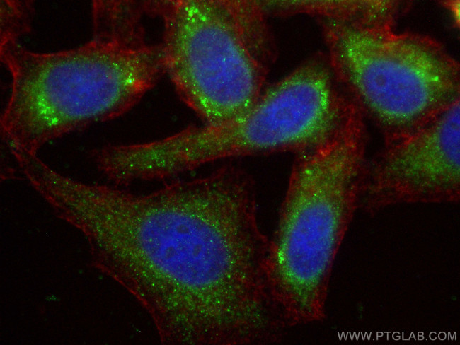 DNAH5 Antibody in Immunocytochemistry (ICC/IF)