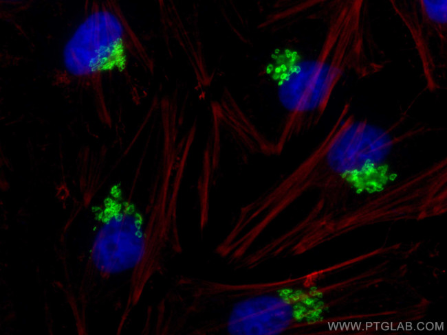 GOLIM4 Antibody in Immunocytochemistry (ICC/IF)