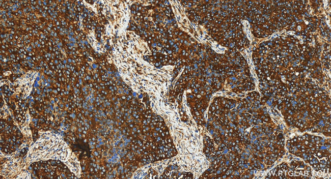 CORO1B Antibody in Immunohistochemistry (Paraffin) (IHC (P))