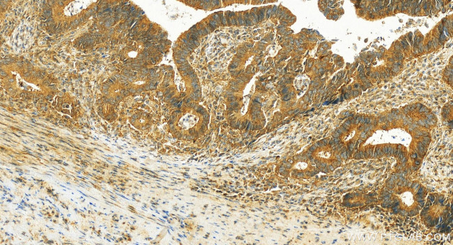 KIAA1199/CEMIP Antibody in Immunohistochemistry (Paraffin) (IHC (P))