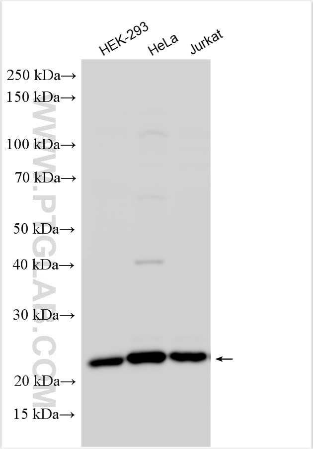 COMMD9 Antibody in Western Blot (WB)