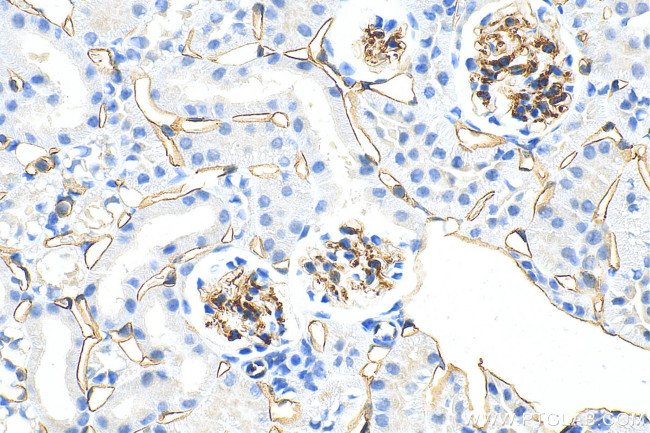 CD34 Antibody in Immunohistochemistry (Paraffin) (IHC (P))