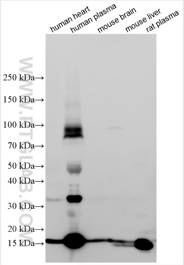RAGE Antibody in Western Blot (WB)