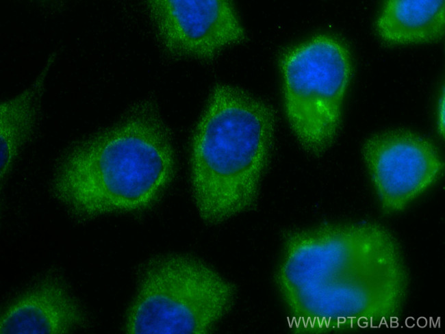 IL-1RA Antibody in Immunocytochemistry (ICC/IF)